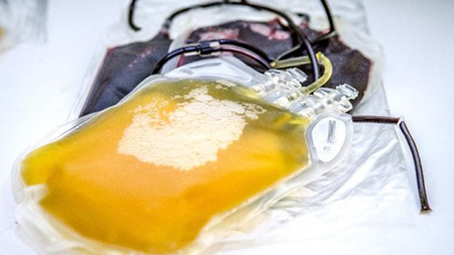 Ảnh minh họa dung dịch nghệ được tiêm vào tĩnh mạch trị bệnh ngoài da. ( Ảnh: Independent)