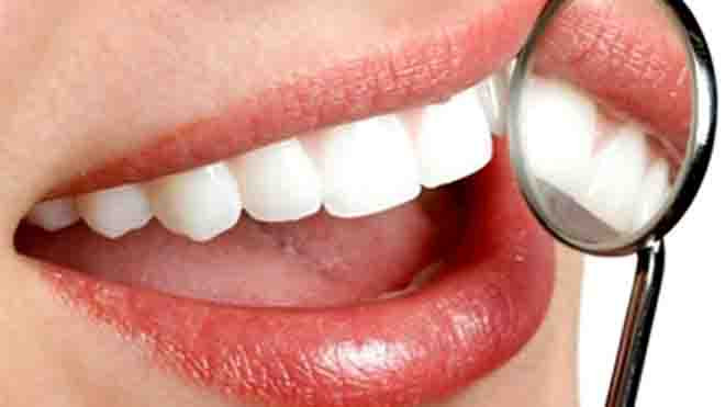 Những thực phẩm tuyệt vời phòng ngừa sâu răng