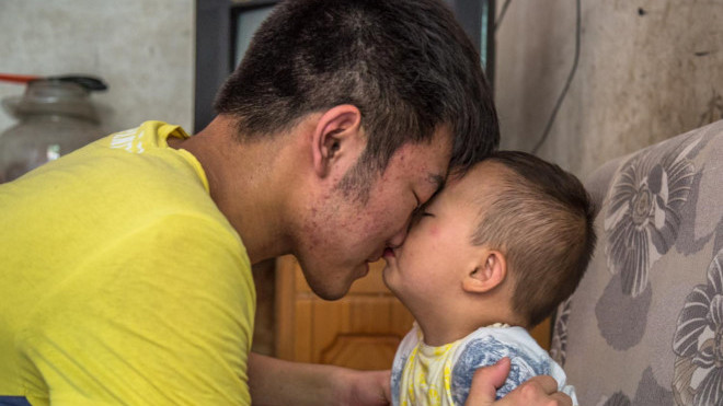 Chàng trai 19 tuổi hết mực yêu thương cậu em bé bỏng không may mắc căn bệnh ung thư máu quái ác.