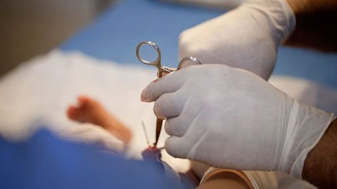 Cắt bao quy đầu có thể để lại nhiều biến chứng nếu chăm sóc không tốt