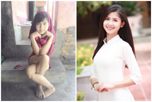 'Hot girl chân khoèo' ngày ấy bây giờ