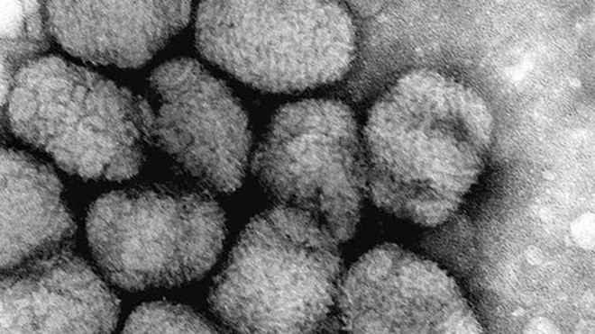 Nhiều loại virus được cho là có thể sống lại dưới tác động của hiện tượng ấm lên toàn cầu. Ảnh minh họa: AFP.