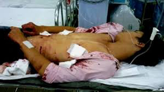 Mang họa sát thân vì tát cha dượng