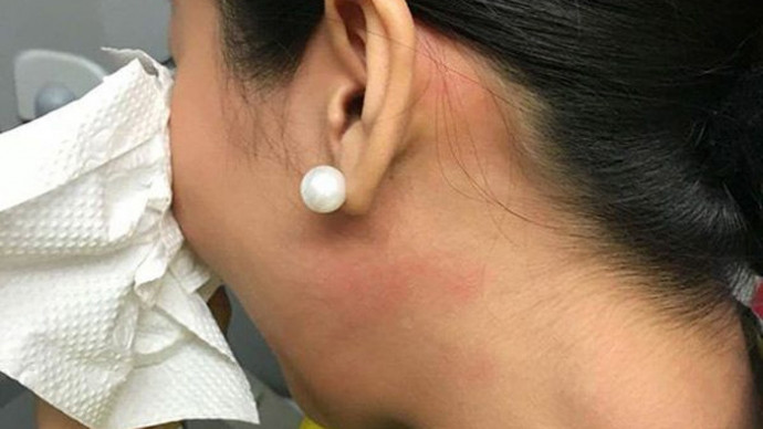 Tiếp viên sau khi bị ông Bình tát 