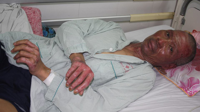 Ông Thảo phải nằm điều trị hơn 1 tháng nay trong viện.