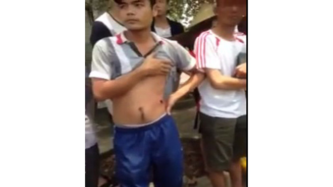 Nguyễn Thanh Nghĩa bị thương vùng bụng sau phát đạn của thiếu úy Trung. Ảnh cắt từ clip.