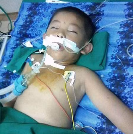 Bị đàn ong tấn công, cháu bé nhập viện trong tình trạng nguy kịch.