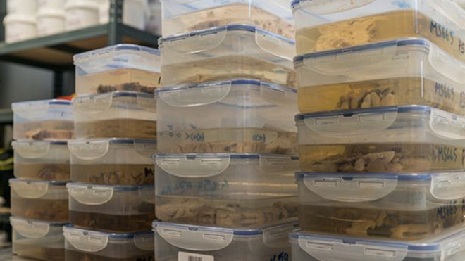 Khám phá ngân hàng chứa 1.000 bộ não người ở Anh