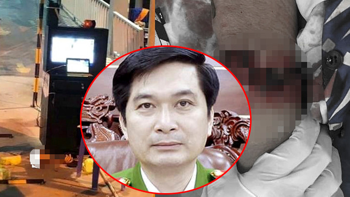 Giám đốc công an Bình Dương lên tiếng vụ 2 người bị chém đứt lìa tay