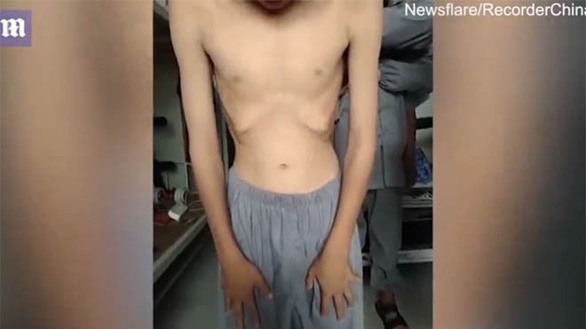 Hai thiếu niên Thiếu Lâm Tự và màn biểu diễn kỳ dị