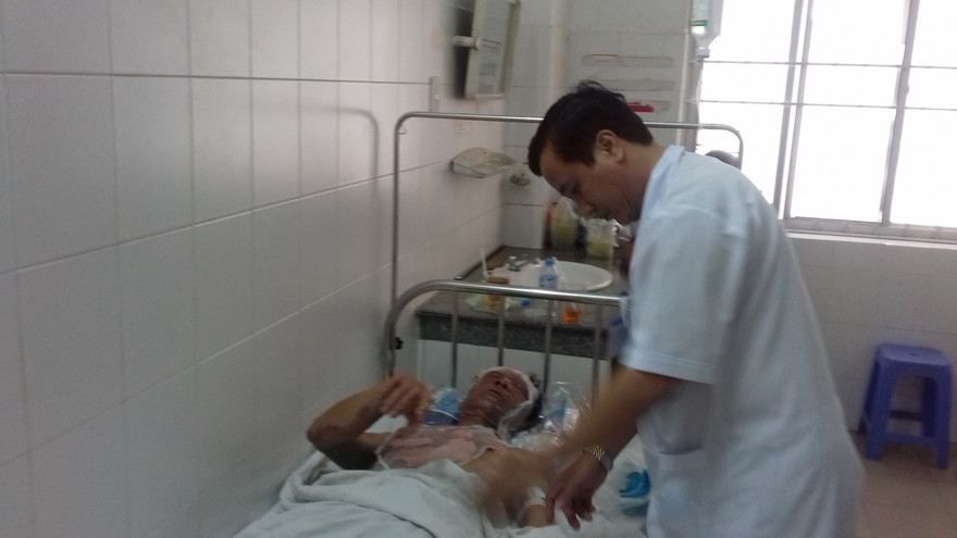 Bệnh nhân bị bỏng cồn đang được điều trị