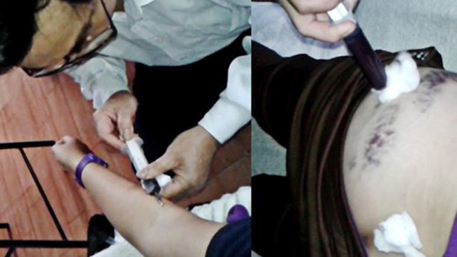 Ông Thành lấy máu từ cánh tay rồi tiêm vào mông một bệnh nhân - Ảnh: C.T.V