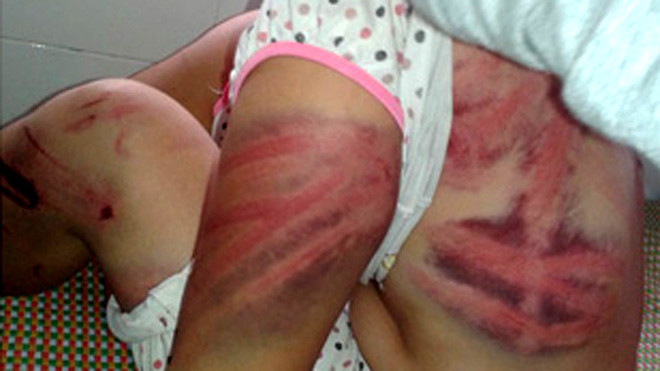 Người chồng đã dùng dây điện đánh tới tấp vào người vợ suốt cả đêm.