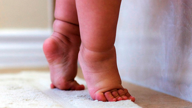 Trẻ đi nhón gót coi chừng bị bất thường ở chân