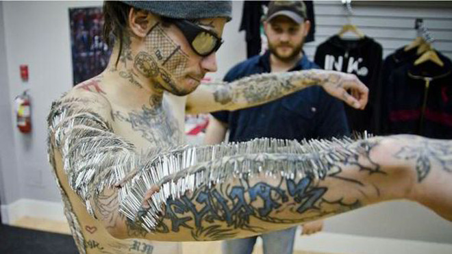 Chịu 4550 mũi kim cắm trên da để phá kỷ lục thế giới