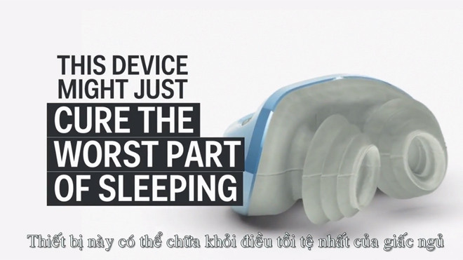 Thiết bị đặc biệt chữa ngáy ngủ