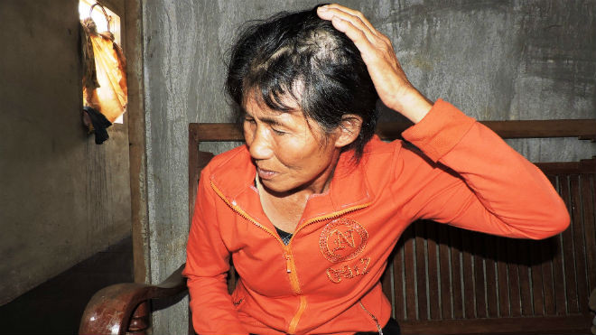 Bà Hường kể bị đối tượng bắt cóc cắt tóc