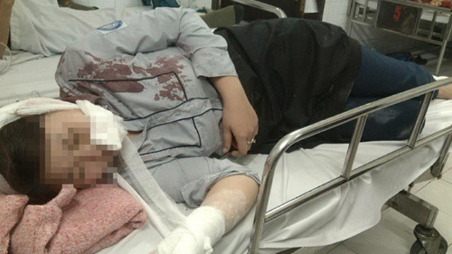 Hoa vẫn chưa hết sợ hãi sau khi bị đánh bất tỉnh.