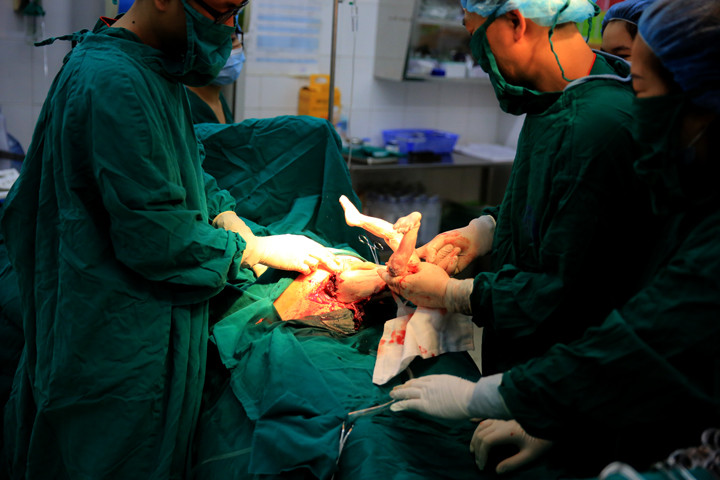 Nín thở xem bác sĩ mổ đẻ ngôi ngược