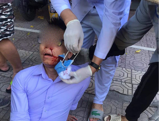 Ông Vũ Văn Pho bị 2 người lạ chặn đường, đánh bất tỉnh - Ảnh: Hoàng Long