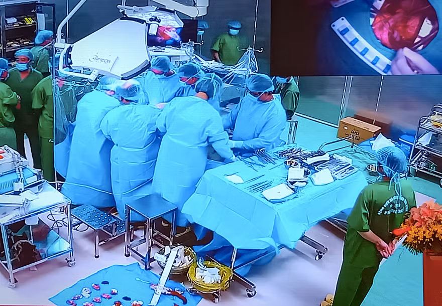 Ca phẫu thuật hở tim đầu tiên tại Thái Bình được thực hiện thành công - Ảnh: Hoàng Long