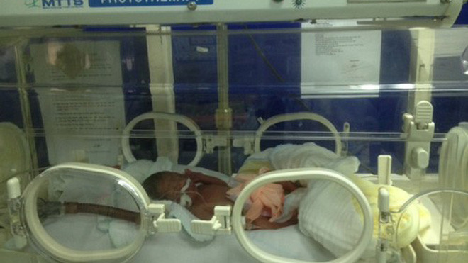 Trẻ đang được chăm sóc đặc biệt, vì sinh non nên cân nặng chỉ được 1,3kg. 