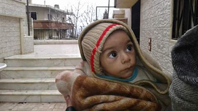 Một em bé bị suy dinh dưỡng nặng trong thị trấn bị vây hãm Madaya. Ảnh: Guardian