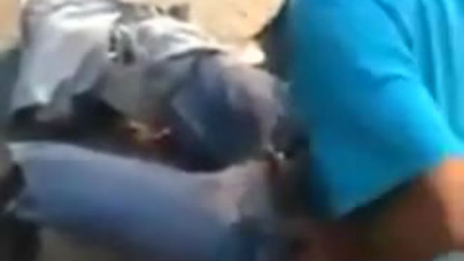 Gã ăn mày giả cụt chân bị lật tẩy