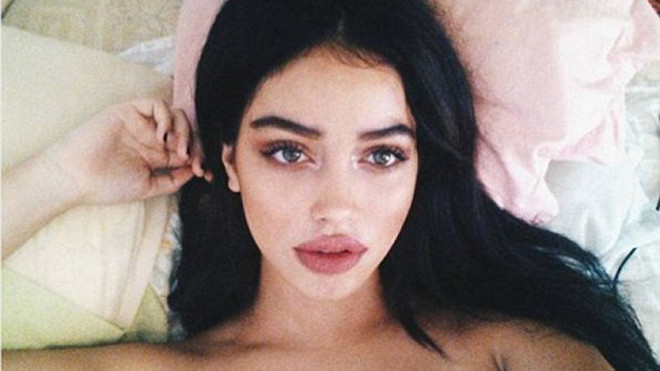 Cindy Kimberly đã bất ngờ trở nên nổi tiếng sau khi được nam ca sĩ Justin Bieber chia sẻ ảnh trên mạng xã hội. Tài khoản của Justin Bieber có tới hơn 50 triệu lượt tài khoản khác “theo dõi”, vì vậy, cô gái đã nhận được sự chú ý của hàng triệu người chỉ nh