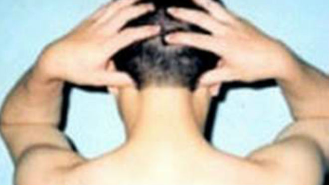 Day huyệt phong trì.