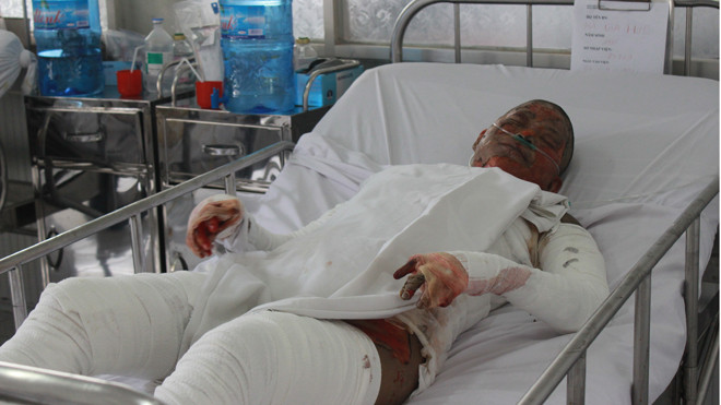 Nạn nhân đang được chăm sóc đặc biệt tại Bệnh viện Chợ Rẫy. Ảnh do bệnh viện cung cấp.