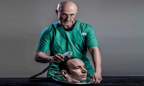 Bác sĩ Sergio Canavero dự định thực hiện phẫu thuật ghép đầu vào năm sau. Ảnh minh họa: The Why.