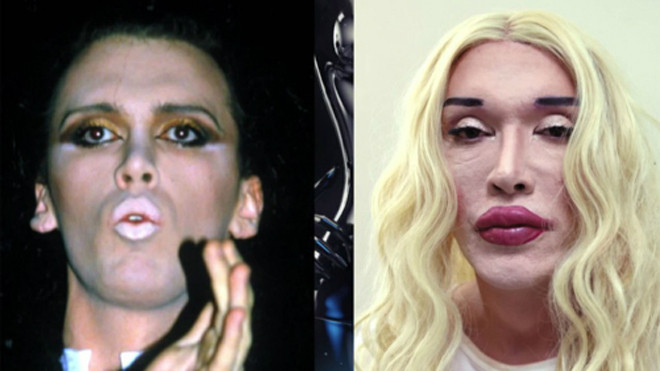 Pete trước và sau khi phẫu thuật thẩm mỹ. Ảnh: Channel 5.