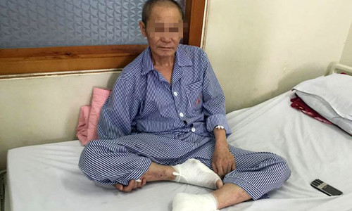 Bệnh nhân bị bỏng nặng ở hai bàn chân. Ảnh: T.N.