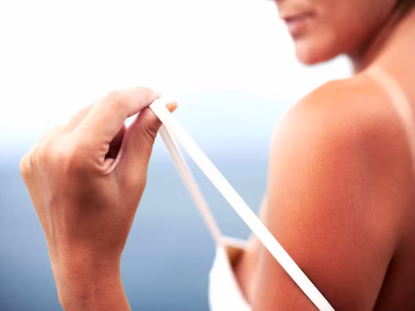 Những mẹo trị da rám nắng siêu tốc mùa hè