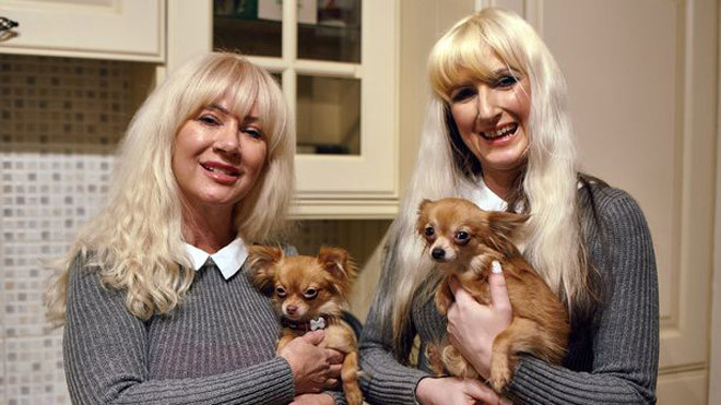 Janet, bà mẹ 57 tuổi, phẫu thuật giống hệt con gái (bên trái)