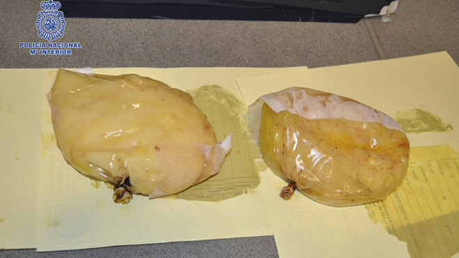 Hai túi ma túy giấu trong ngực một phụ nữ Panama bị phát hiện ở sân bay Barcelona, Tây Ban Nha hồi tháng 12/2012. Ảnh: Reuters