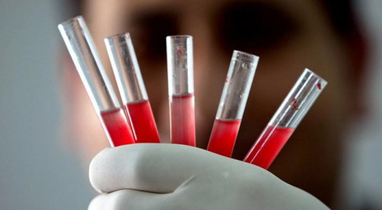 Tạo được tế bào máu và tế bào miễn dịch từ tế bào da