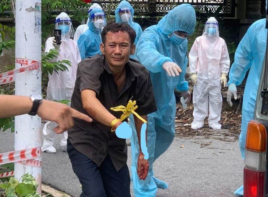 Nạn nhân bị chém đứt lìa cánh tay