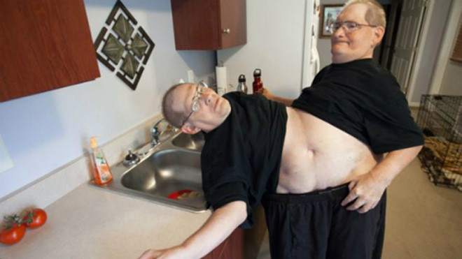 Ronnie và Donnie Galyon cùng nhau làm mọi việc. Ảnh: Health.