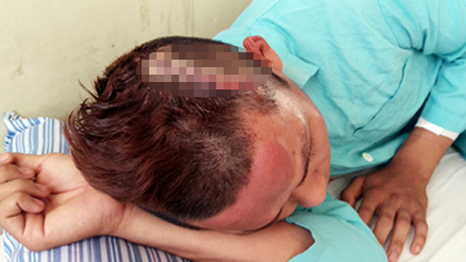 Nạn nhân bị nhóm thanh niên truy sát. Ảnh: Xuân Ngọc