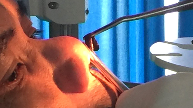 Con đỉa đang được gắp ra khỏi mũi ông Pi Năng L. 