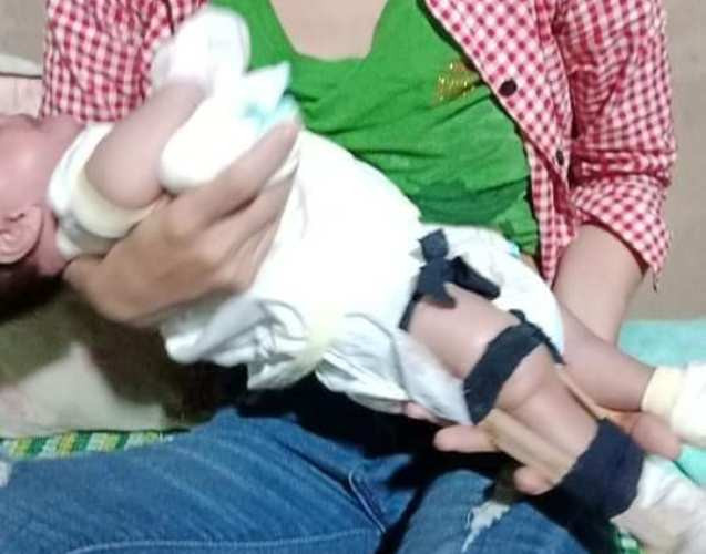 Thực hư cha đạp gãy chân bé sơ sinh vì 'quấy khóc'