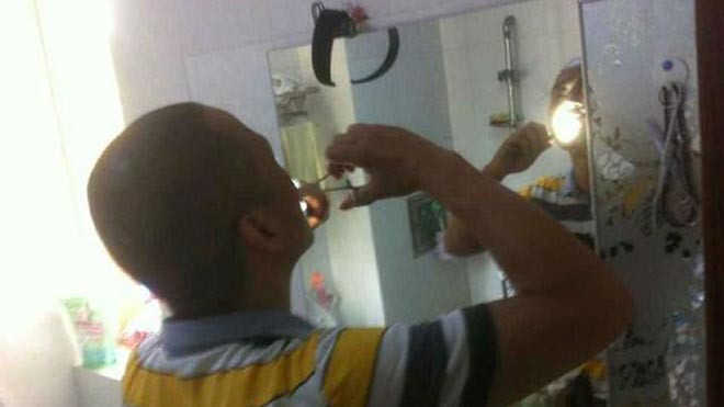  Anh Yu đã hơn 10 lần tư phẫu thuật 'tại gia'