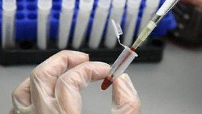 Phụ nữ cần làm một số xét nghiệm trước khi điều trị vô sinh.