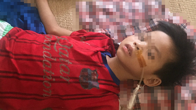 Bệnh nhi uống nhầm axit được điều trị tại Bệnh viện Nhi trung ương. Ảnh: Khánh Chi/ VnExpress