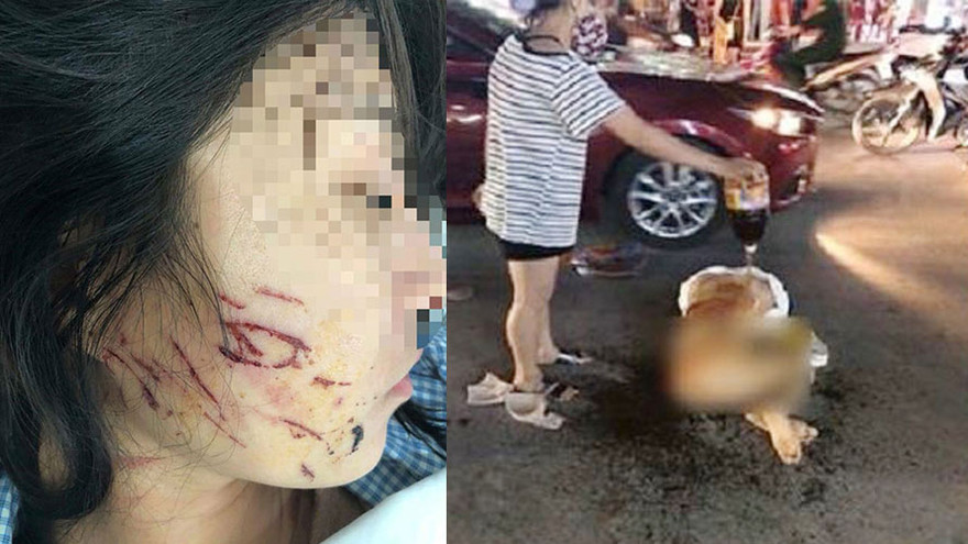 Nạn nhân bị đổ mắm và muối ớt lên người, khuôn mặt cũng bị nhiều vết rách