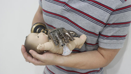 Bàn tay giả được bọc lớp da nhân tạo thông minh có thể tạo cảm giác về thân nhiệt. Ảnh: CBS News