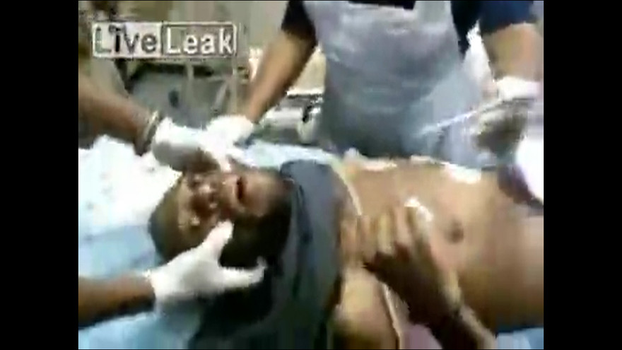 Thanh niên suýt chết vì nuốt iPhone bất thành