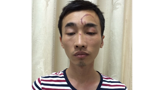 Nghiên trộm tài sản của nhiều phụ nữ mới quen.